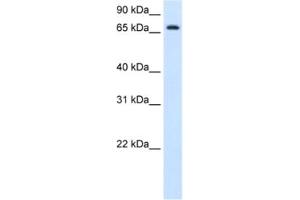 Western Blotting (WB) image for anti-Histidine Ammonia-Lyase (HAL) antibody (ABIN2462882)