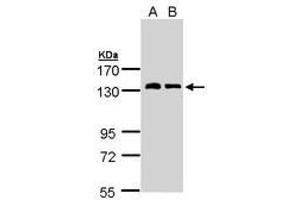 Image no. 1 for anti-Natriuretic Peptide Receptor A/guanylate Cyclase A (Atrionatriuretic Peptide Receptor A) (NPR1) (AA 640-886) antibody (ABIN467522) (NPR1 antibody  (AA 640-886))