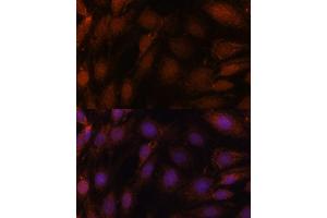 Immunofluorescence analysis of C6 cells using GCAT antibody (ABIN7267461) at dilution of 1:100. (GCAT antibody  (AA 170-419))