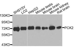 Western blot analysis of extracts of various cell lines, using PCK2 antibody. (PEPCK antibody  (AA 1-280))