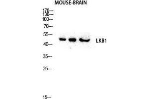 Western Blot (WB) analysis of Mouse Brain lysis using LKB1 antibody. (LKB1 antibody  (Tyr1313))