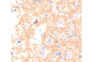 Figure. (Peroxiredoxin 2 antibody  (AA 6-164))