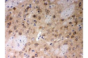 IHC-P: PP2A antibody testing of rat brain tissue (PPP2R4 antibody  (AA 1-309))