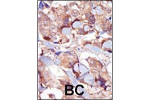Immunohistochemistry (Paraffin-embedded Sections) (IHC (p)) image for anti-Myosin Light Chain Kinase 3 (MYLK3) (AA 40-69), (N-Term) antibody (ABIN392494)