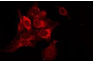 ABIN6278417 staining NIH-3T3 by IF/ICC. (TACR2 antibody  (C-Term))