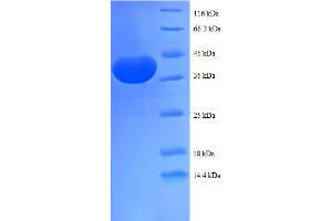 SDS-PAGE (SDS) image for Prefoldin Subunit 1 (PFDN1) (AA 2-122) protein (GST tag) (ABIN5712155) (PFDN1 Protein (AA 2-122) (GST tag))