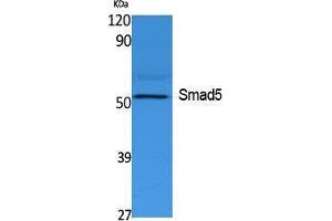 Western Blotting (WB) image for anti-SMAD, Mothers Against DPP Homolog 5 (SMAD5) (Internal Region) antibody (ABIN3178118) (SMAD5 antibody  (Internal Region))