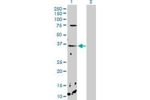 Western Blot analysis of CHP expression in transfected 293T cell line by CHP MaxPab polyclonal antibody. (CHP antibody  (AA 1-195))