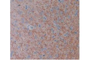 Detection of FGF1 in Rat Brain Tissue using Monoclonal Antibody to Fibroblast Growth Factor 1, Acidic (FGF1) (FGF1 antibody  (AA 16-155))