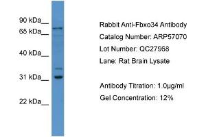 WB Suggested Anti-Fbxo34  Antibody Titration: 0. (FBXO34 antibody  (N-Term))