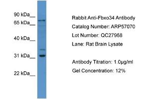 WB Suggested Anti-Fbxo34  Antibody Titration: 0. (FBXO34 antibody  (N-Term))