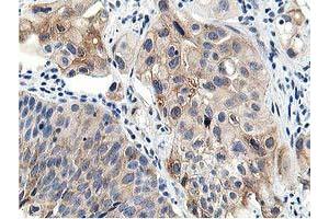 Image no. 5 for anti-Leucine Carboxyl Methyltransferase 1 (LCMT1) antibody (ABIN1499107) (LCMT1 antibody)