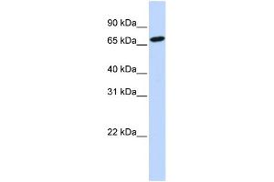 WB Suggested Anti-HAL Antibody Titration:  1 ug/ml  Positive Control:  721_B cell lysate (HAL antibody  (N-Term))