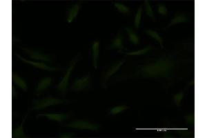 Immunofluorescence of monoclonal antibody to EMX2 on HeLa cell. (EMX2 antibody  (AA 103-200))