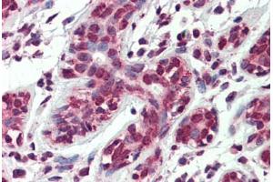 Human Breast: Formalin-Fixed, Paraffin-Embedded (FFPE) (ARL2 antibody  (AA 123-184))