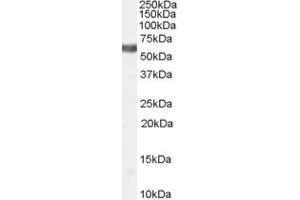 ABIN334451 (2µg/ml) staining of Human Thyroid lysate (35µg protein in RIPA buffer). (NR4A1 antibody  (Internal Region))