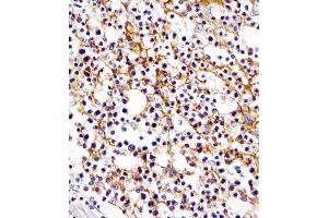 Antibody staining D11b in human tonsil tissue sections by Immunohistochemistry (IHC-P - paraformaldehyde-fixed, paraffin-embedded sections).