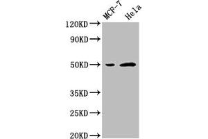 Western Blot Positive WB detected in: MCF-7 whole cell lysate, Hela whole cell lysate All lanes: SLC16A3 antibody at 1:2500 Secondary Goat polyclonal to rabbit IgG at 1/50000 dilution Predicted band size: 50 kDa Observed band size: 50 kDa (SLC16A3 antibody  (AA 406-465))