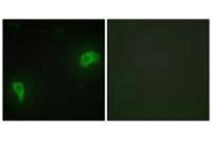 Immunofluorescence analysis of HepG2 cells, using DOK7 antibody. (DOK7 antibody  (N-Term))