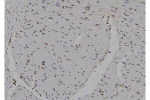 ABIN6277154 at 1/100 staining Human gastric tissue by IHC-P.