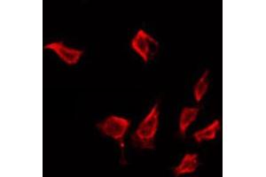 ABIN6272326 staining LOVO by IF/ICC. (IFIT1 antibody  (Internal Region))