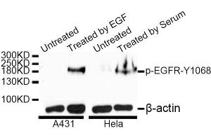 Western blot analysis of extracts of A-431 and HeLa cells, using Phospho-EGFR-Y1068 antibody. (EGFR antibody  (pTyr1068))