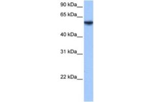 Western Blotting (WB) image for anti-Inositol-3-Phosphate Synthase 1 (ISYNA1) antibody (ABIN2463597) (ISYNA1 antibody)