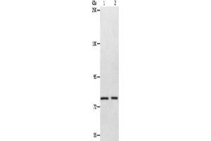 Gel: 8 % SDS-PAGE, Lysate: 40 μg, Lane 1-2: Mouse liver tissue, SP20 cells, Primary antibody: ABIN7128119(ABCB6 Antibody) at dilution 1/320, Secondary antibody: Goat anti rabbit IgG at 1/8000 dilution, Exposure time: 1 minute
