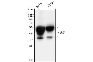Western blot analysis of CD147/Emmprin using anti-CD147/Emmprin antibody (ABIN5518743). (CD147 antibody  (AA 138-323))