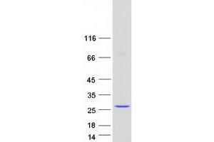 EF-Hand Calcium Binding Domain 2 (EFCAB2) (Transcript Variant 1) protein (Myc-DYKDDDDK Tag)