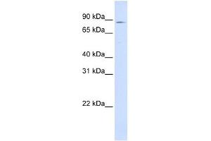 CPT1A antibody used at 1 ug/ml to detect target protein.