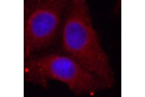 Immunofluorescence staining of methanol-fixed HeLa cells using Phospho-GAP43-S41 antibody (ABIN2988022). (GAP43 antibody  (pSer41))