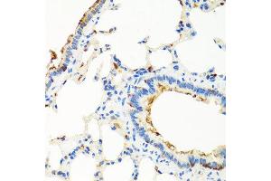 Immunohistochemistry of paraffin-embedded rat lung using RGS5 antibody at dilution of 1:100 (x40 lens). (RGS5 antibody)