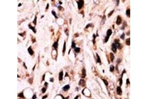 Immunohistochemistry (IHC) image for anti-SMAD Family Member 4 (SMAD4) (pThr277) antibody (ABIN3032606)