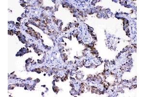 IHC analysis of Adenylosuccinate Lyase using anti-Adenylosuccinate Lyase antibody . (ASL antibody)
