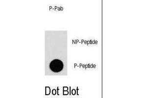 Dot Blot (DB) image for anti-Epidermal Growth Factor Receptor (EGFR) (pTyr1092) antibody (ABIN2971003)
