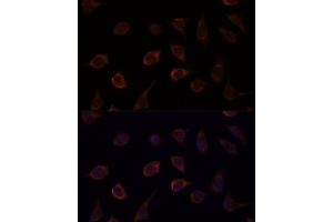 Immunofluorescence analysis of L929 cells using DUSP8 antibody (ABIN7266849) at dilution of 1:100. (DUSP8 antibody)