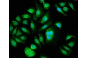 Immunofluorescence staining of A549 cells with ABIN7169157 at 1:133, counter-stained with DAPI. (PLK1 antibody  (AA 1-603))
