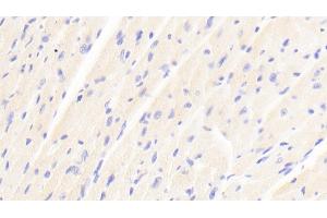 Immunohistochemistry (IHC) image for anti-Chemokine (C-C Motif) Ligand 17 (CCL17) (AA 501-695) antibody (ABIN7445003)