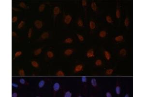 Immunofluorescence analysis of U-2 OS cells using MED25 Polyclonal Antibody at dilution of 1:100 (40x lens). (MED25 antibody)