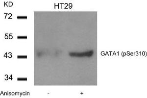 Western blot analysis of extracts from HT29 cells untreated or treated with Anisomycin using GATA1(Phospho-Ser310) Antibody. (GATA1 antibody  (pSer310))