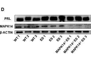 Effects of MAPK14 knockout on the development of prolactinoma in ES-induced mice.