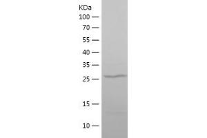 Western Blotting (WB) image for Methyl CpG Binding Protein 2 (MECP2) (AA 329-486) protein (His tag) (ABIN7123936) (MECP2 Protein (AA 329-486) (His tag))