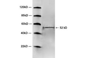 Western blot analysis of mouse brain tissue lysate using 1 µg/mL Rabbit Anti-5HT2A Receptor Polyclonal Antibody (ABIN398705) The signal was developed with IRDyeTM 800 Conjugated Goat Anti-Rabbit IgG.