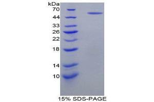 SDS-PAGE (SDS) image for Netrin 1 (NTN1) (AA 313-565) protein (His tag,GST tag) (ABIN1879774)