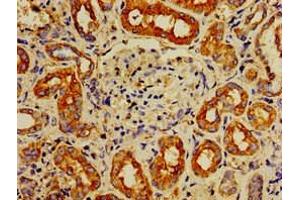 Immunohistochemistry of paraffin-embedded human kidney tissue using ABIN7143048 at dilution of 1:100 (IPP antibody  (AA 444-515))