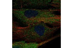 Immunofluorescent staining of BJ cells with ALPK2 polyclonal antibody  (Green) shows localization to cytosol.