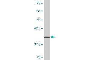Western Blot detection against Immunogen (37. (ATP4b antibody  (AA 67-176))
