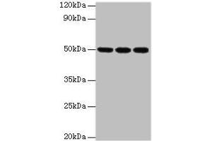 Western blot All lanes: HAT1 antibody at 3 μg/mL Lane 1: MCF-7 whole cell lysate Lane 2: 293T whole cell lysate Lane 3: HepG2 whole cell lysate Secondary Goat polyclonal to rabbit at 1/10000 dilution Predicted band size: 50, 40 kDa Observed band size: 50 kDa (HAT1 antibody  (Catalytic Subunit))