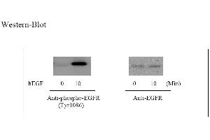 Image no. 6 for Epidermal Growth Factor Receptor (EGFR) ELISA Kit (ABIN625237)
